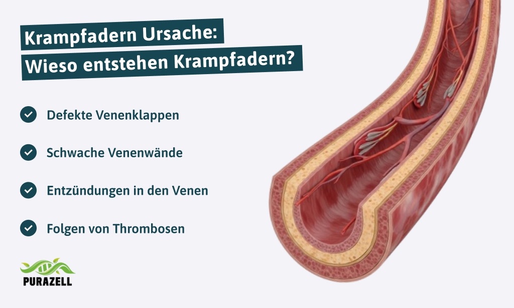 krampfadern-vorbeugen-kaltes-wasser