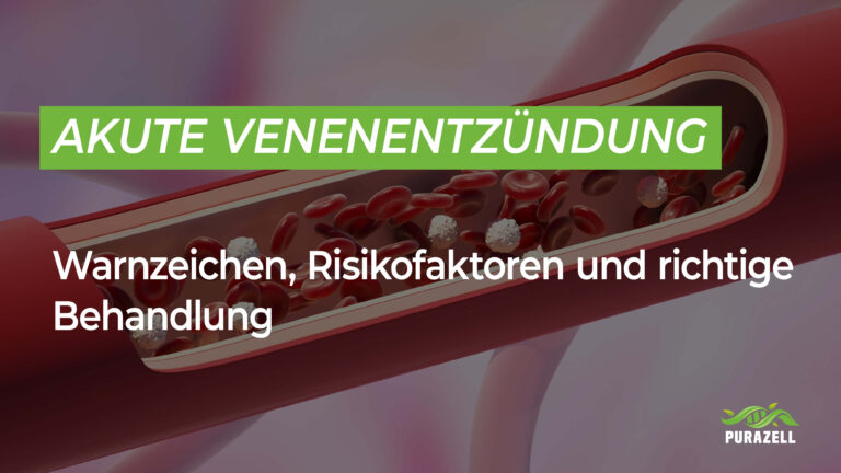 Akute Venenentzündung