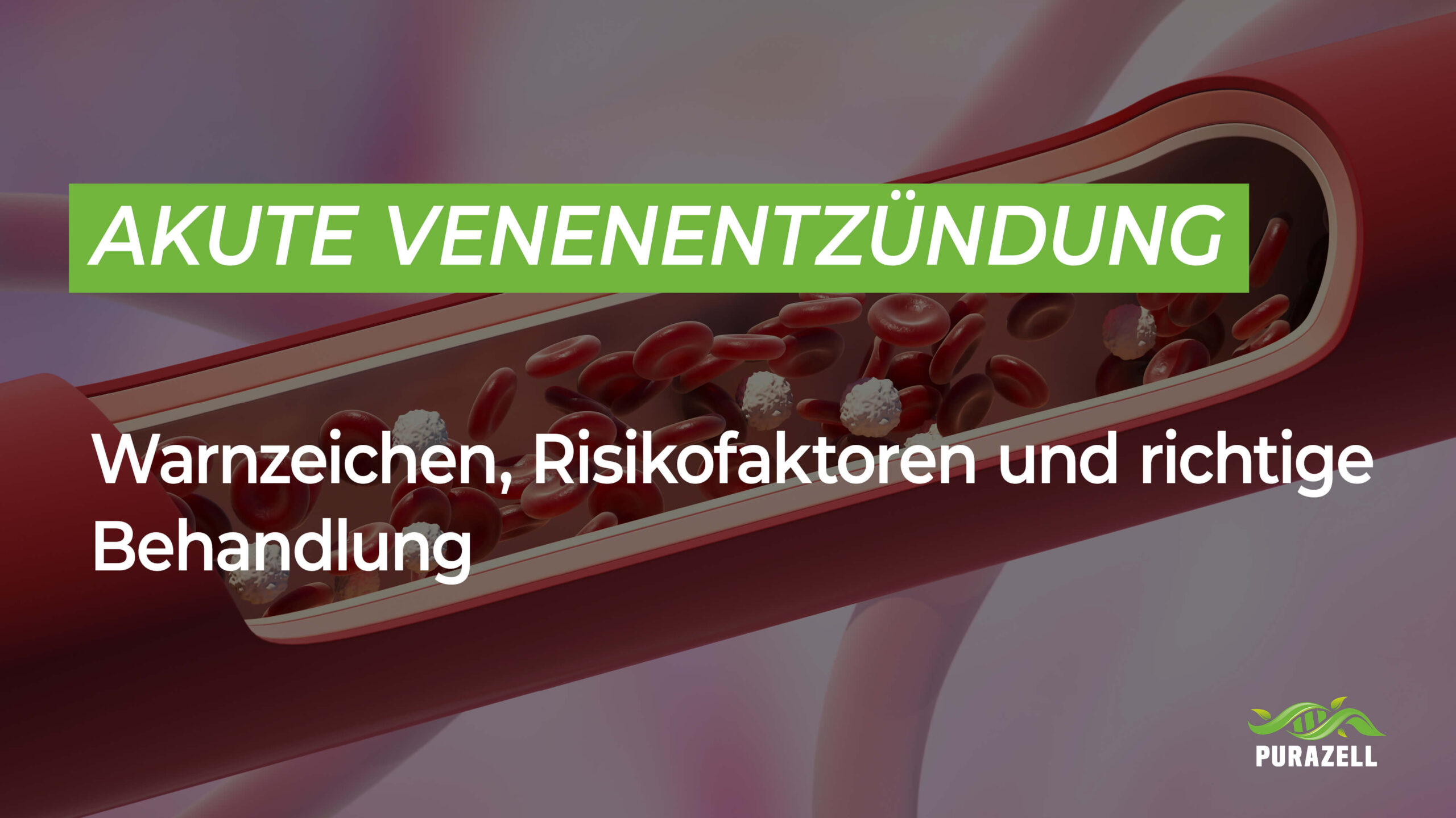 Akute Venenentzündung