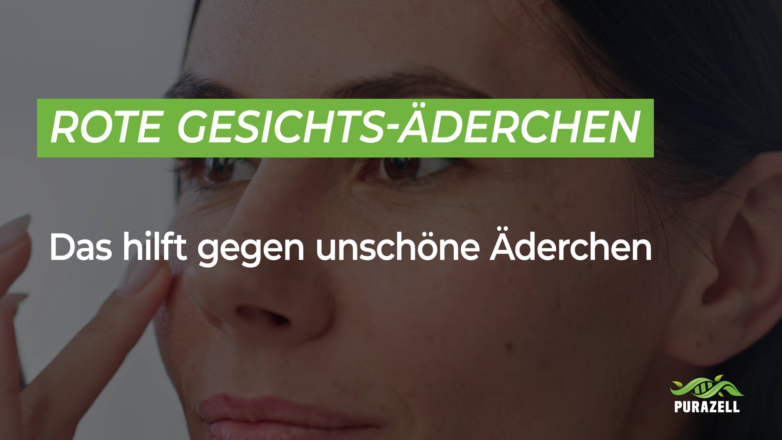 Rote Gesichts-Äderchen