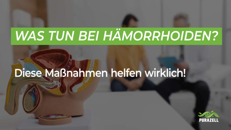 Was tun bei Hämorrhoiden