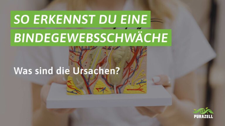 bindegewebsschwaeche