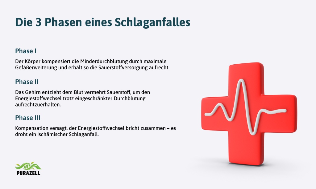 durchblutungsstoerungen-gehirn-drei-phasen-schlaganfall