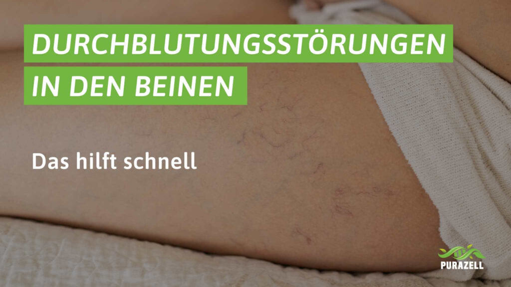 durchblutungsstoerungen-im-bein