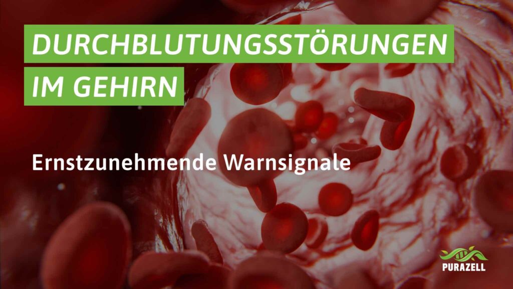 durchblutungsstoerungen-im-gehirn