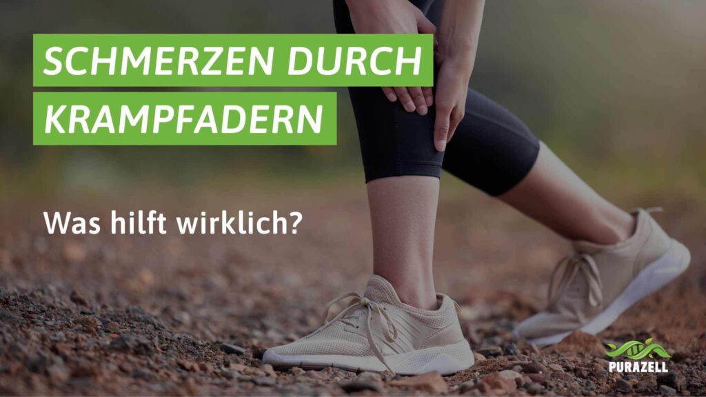 krampfadern-schmerzen-beitragsbilder