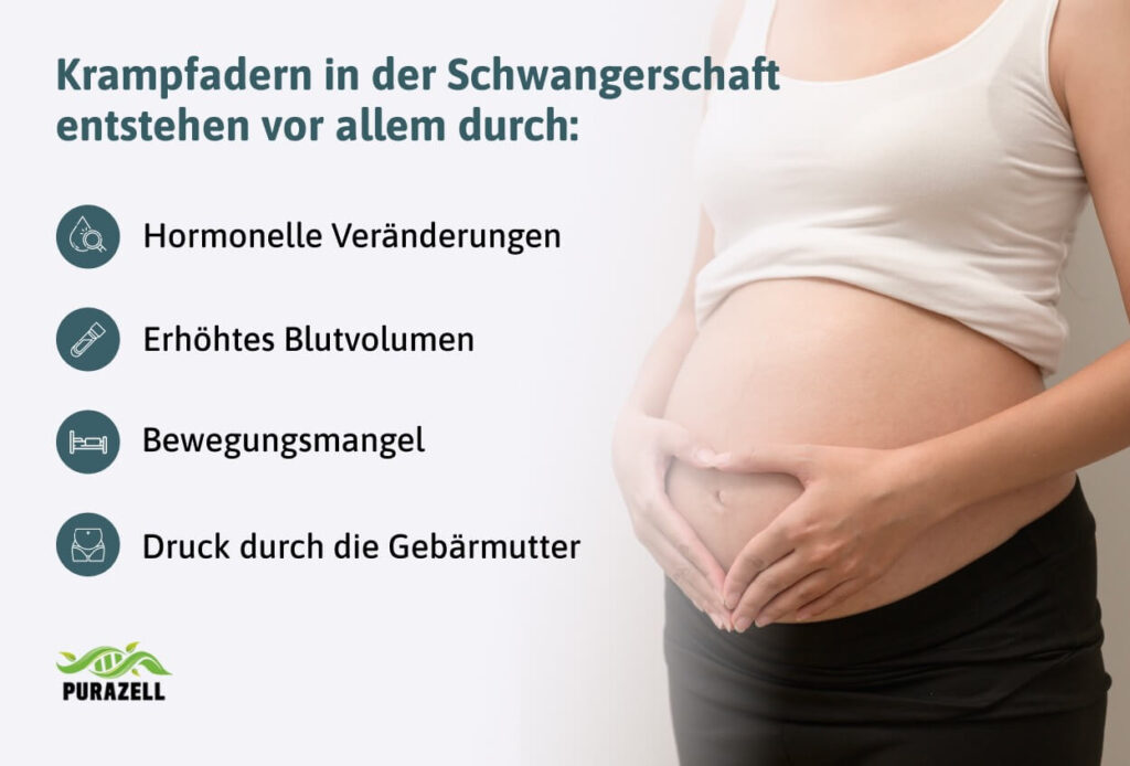 krampfadern-schwangerschaft-entstehung