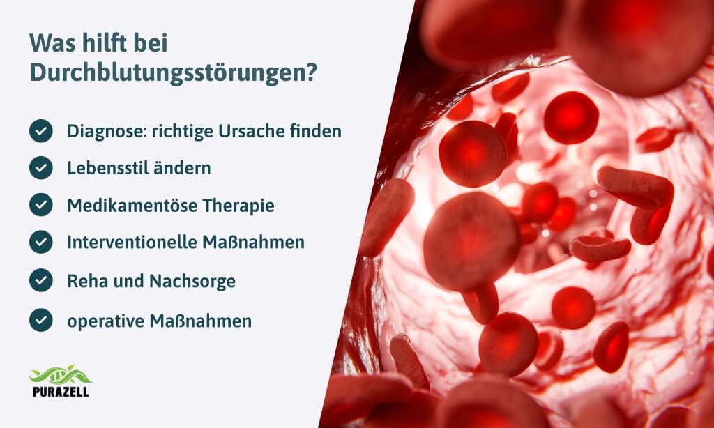 durchblutungsstoerungen-was-hilft