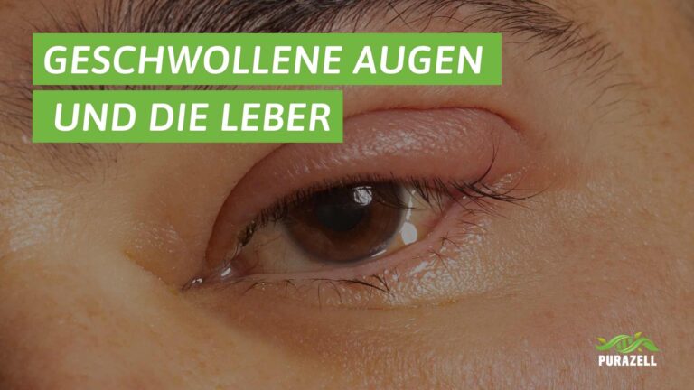 geschwollene-augen-leber