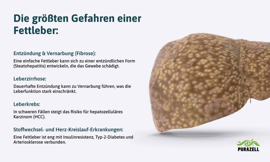 loewenzahn-leber-entgiften-größte-gefahren-fettleber