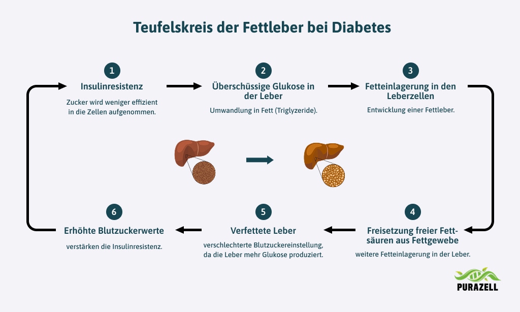 fettleber-teufelskreislauf-diabetes