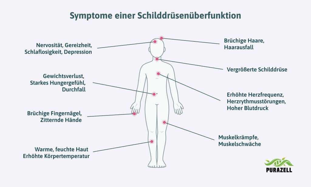 schilddruesenueberfunktion-symptome-am-koerper