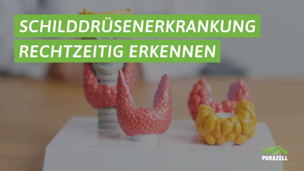 schilddruesenerkrankung