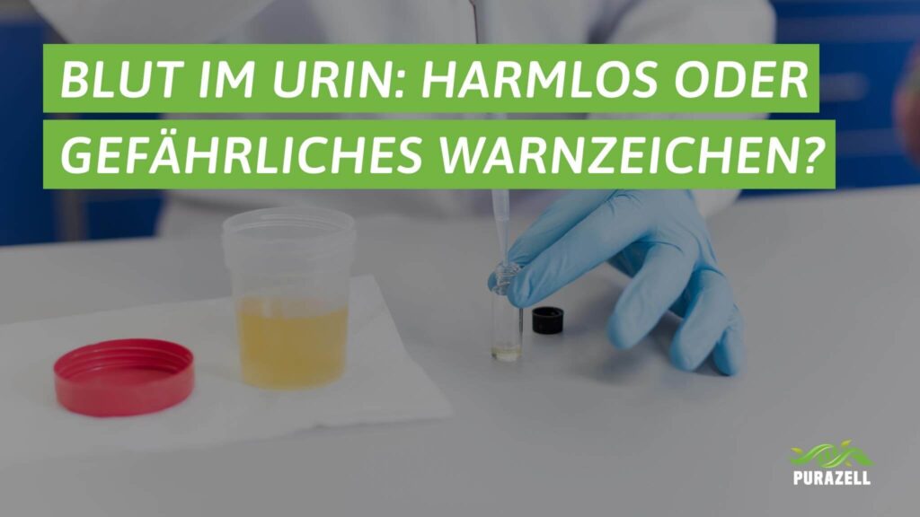 blut-im-urin