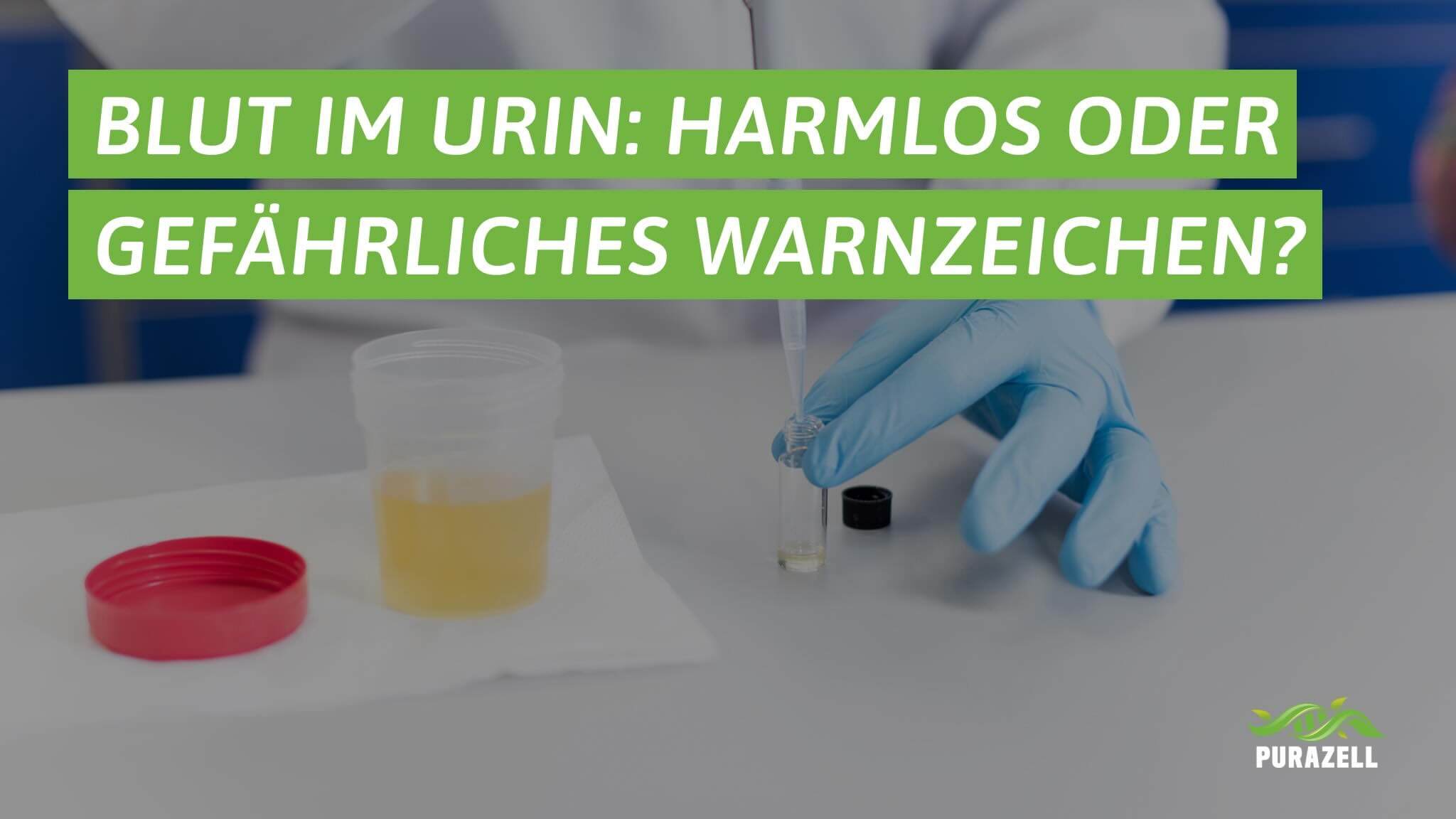 blut-im-urin