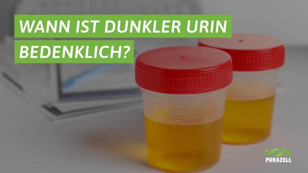 dunkler-urin