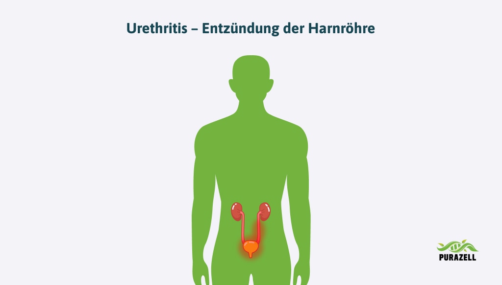 harnroehrenentzuendung-urenthritis