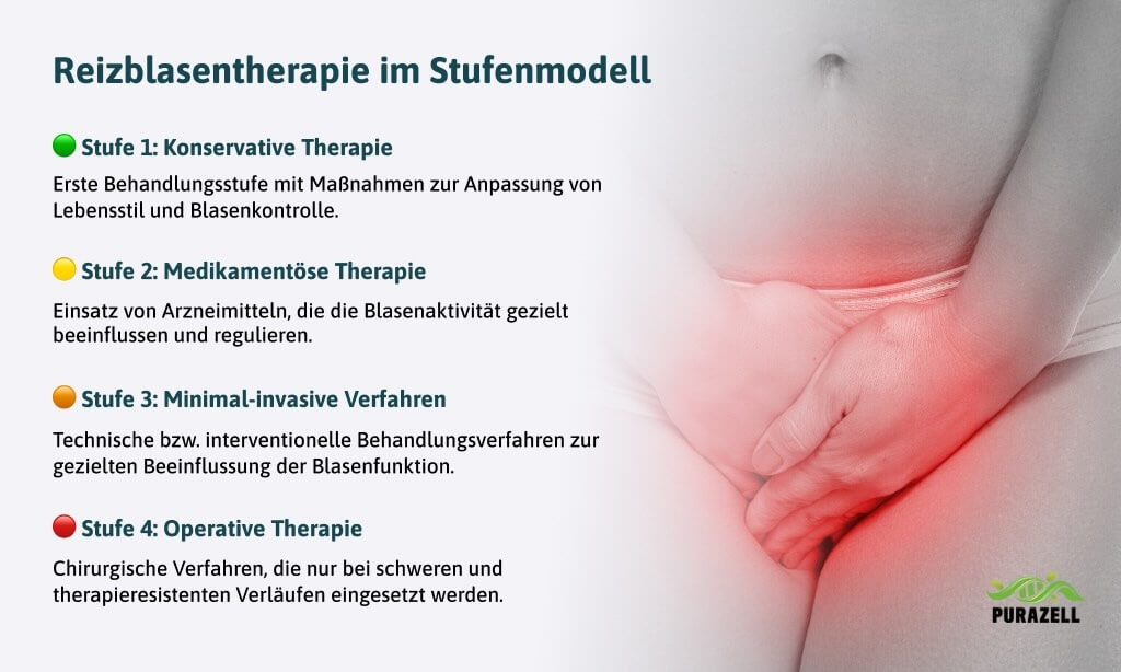 reizblase- stufenmodell